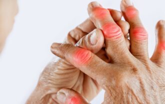 Joint Pain and Stifness